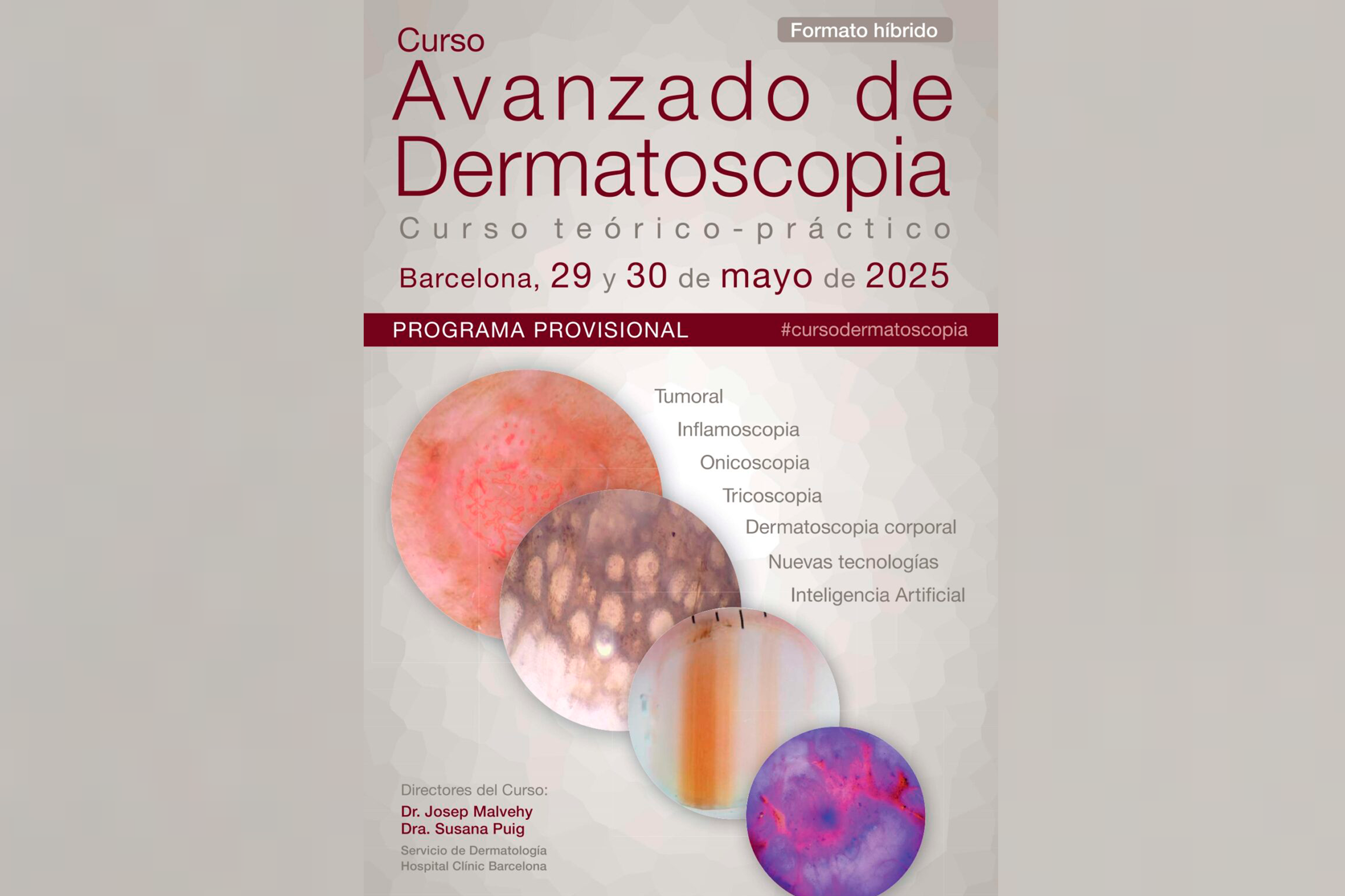 Curs Avançat de Dermatoscòpia