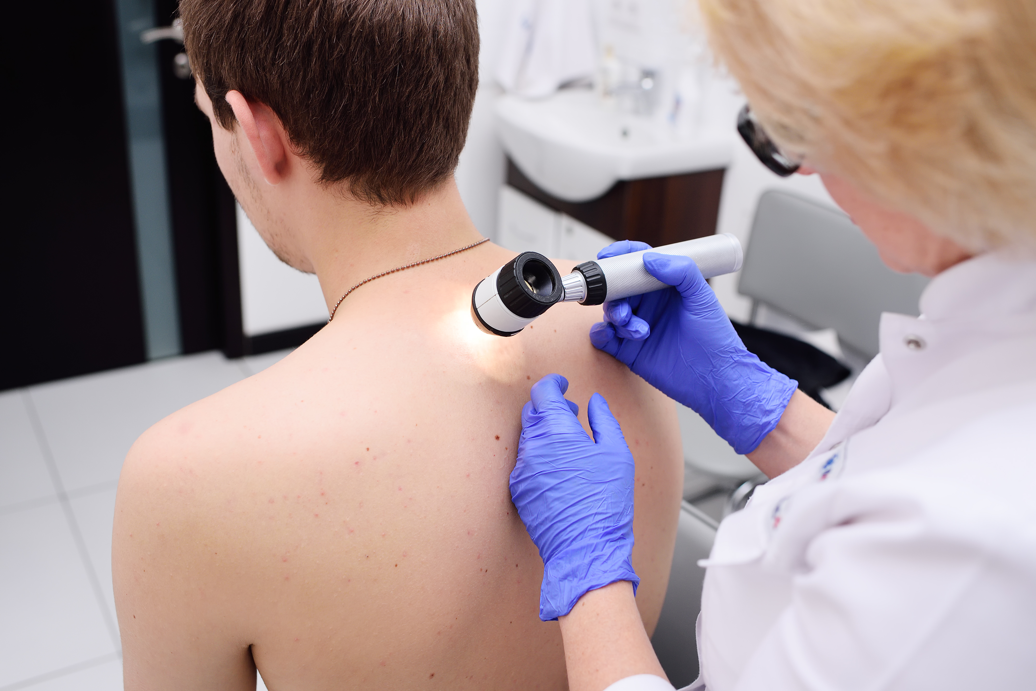 Introducció a la dermatoscòpia a l´Atenció Primària