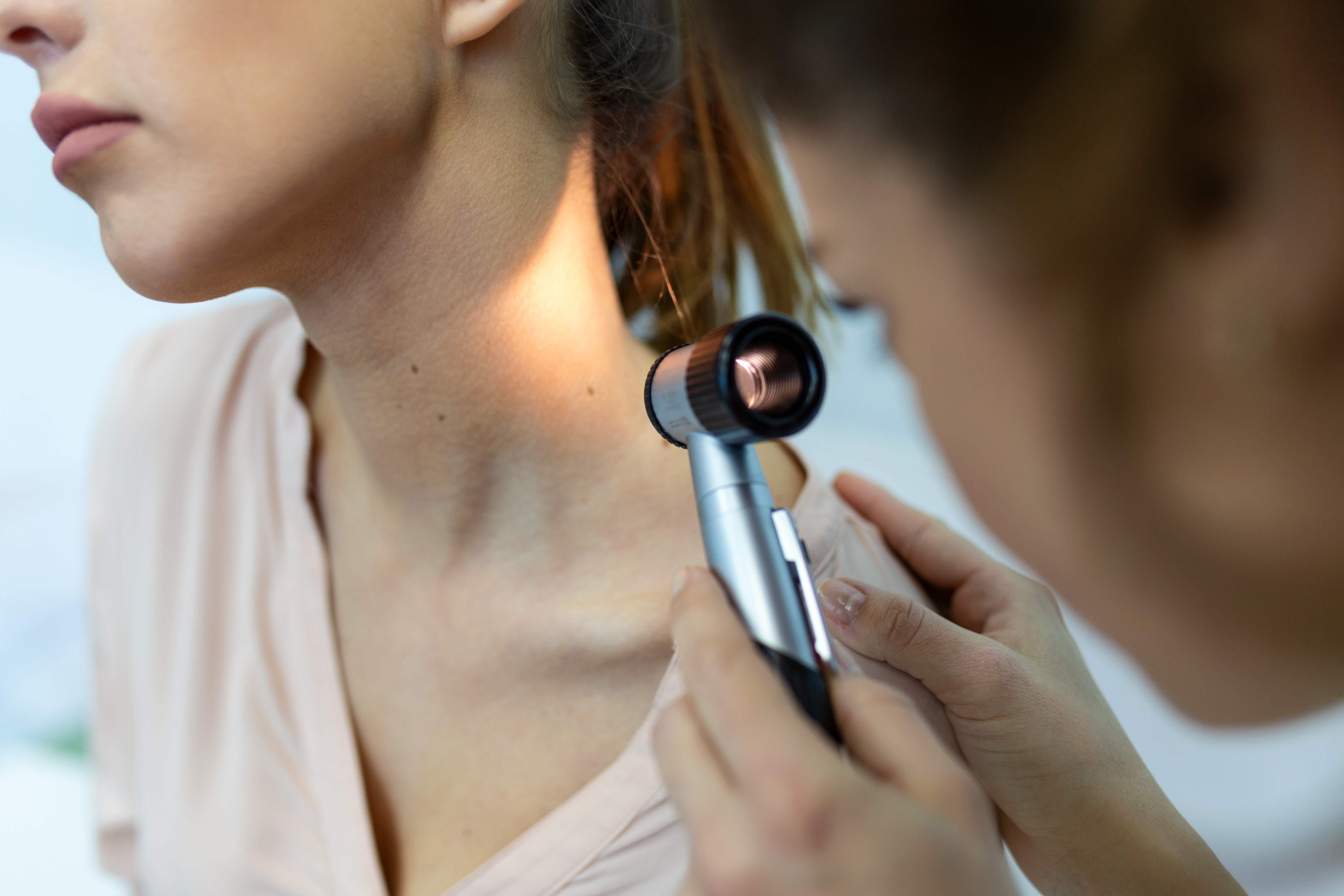 Dermatoscòpia avançada a l´Atenció Primària