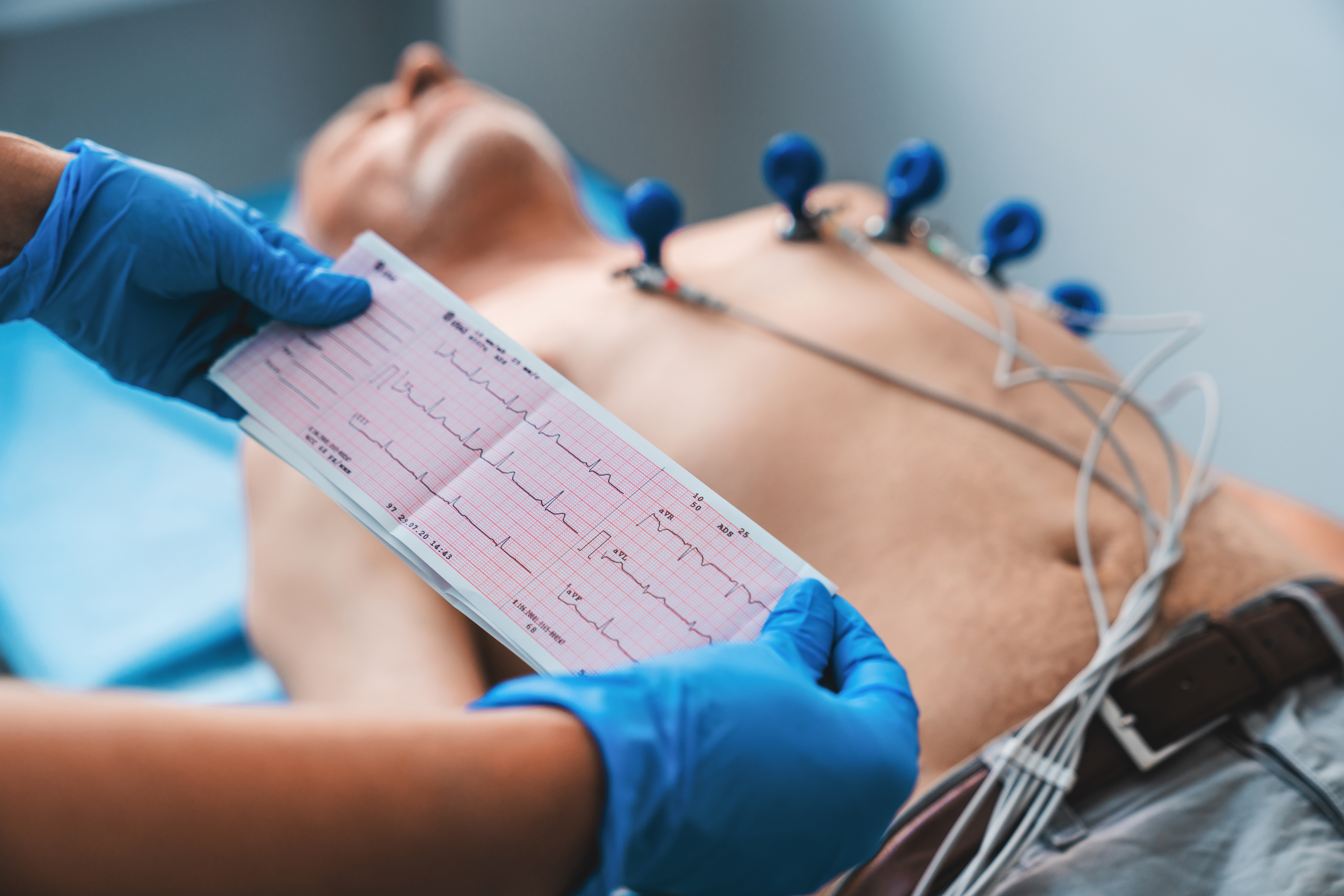 Avançat d’electrocardiografia