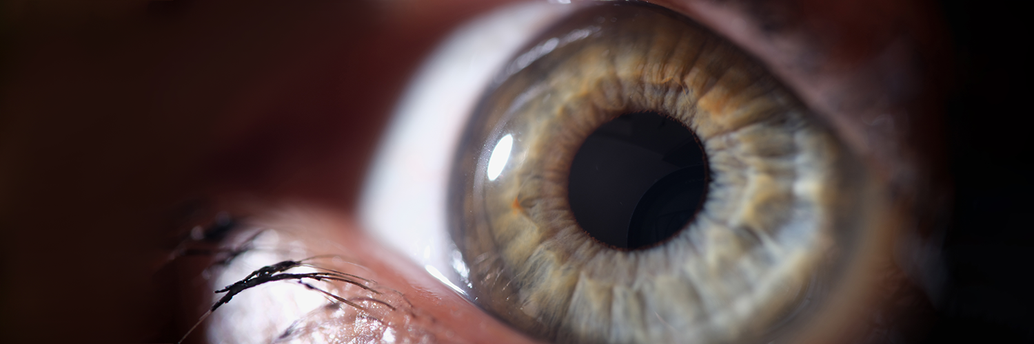 Retinografia no midriàtica en la població diabètica per a l´Atenció Primària