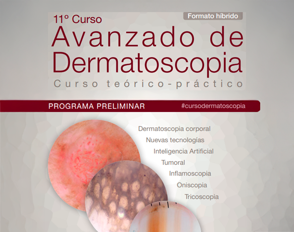 Curs avançat de dermatoscòpia